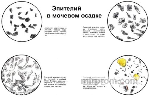 Микроскопическое исследование осадка мочи